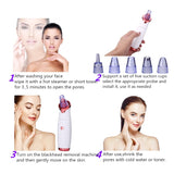 Acne Vacuum Suction Black Head Pore Cleaning