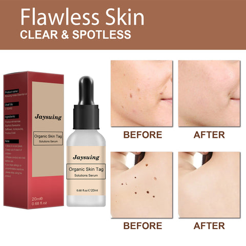Mole Elimination Cream Repair To Remove Black Moles And Black Spots On The Body