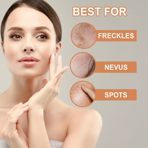 Mole Elimination Cream Repair To Remove Black Moles And Black Spots On The Body