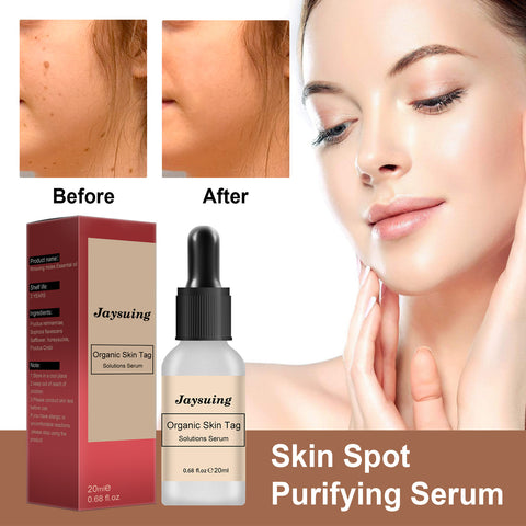 Mole Elimination Cream Repair To Remove Black Moles And Black Spots On The Body